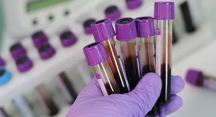 1650012122277012709.jpg diagnosis-of-cancer-through-a-drop-of-blood-picture-1-Zy0FQ5p9P.jpg